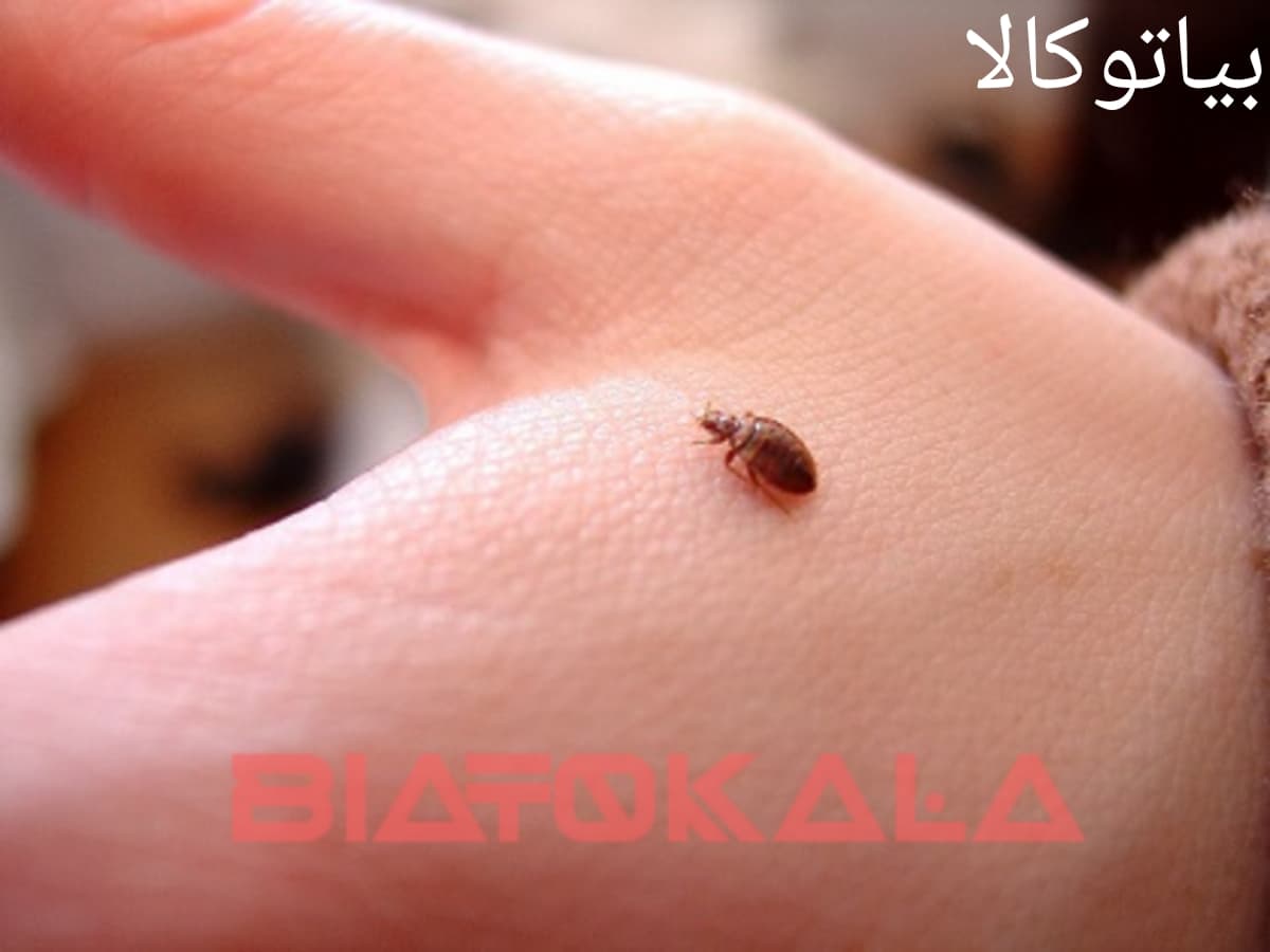 ریشه کنی ساس